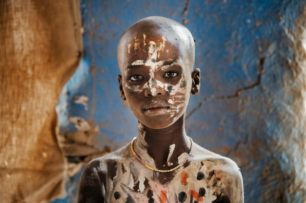 埃塞俄比亚“被诅咒”的部落儿童