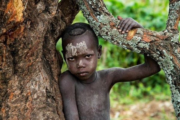 埃塞俄比亚“被诅咒”的部落儿童