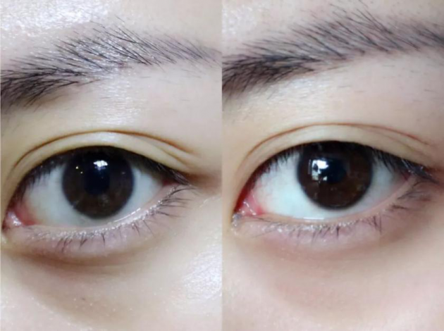 0952212P2-4.png